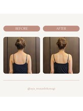 美容整体 綾/ビフォーアフター