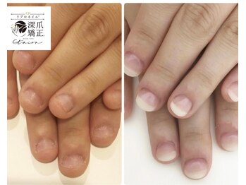 トイロ(toiro)/年齢性別関係なく爪は変わります