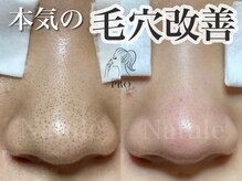ナチュール(Natule)