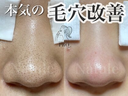 ナチュール(Natule)の写真