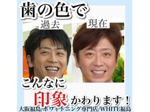 ホワイトニングサロン ホワイト(WHITE)/セルフホワイトニング/大阪/福島