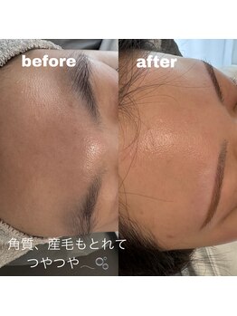 ミィ 立川(m/e.)/フェイスワックス