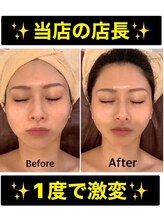 スペチアーレ 夙川/引上りで横顔も更に美しく小顔に