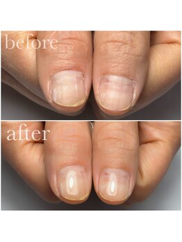 パラジェル☆美爪育成ネイルケア