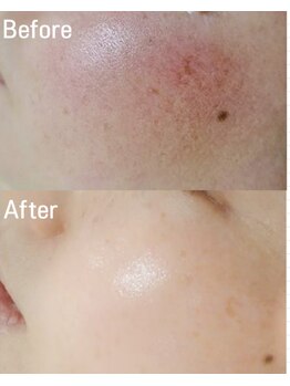 マインエム(mine.m)/敏感肌の方(SEN管理)