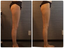 美容整体 ウェリナ 蟹江院/小顔矯正/骨盤矯正/美脚サロン