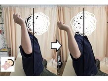 ぐっすり整体 福岡天神院/肩の痛み　外旋制限