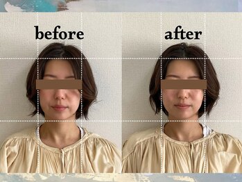 寝譜(nefu)/美容鍼BeforeAfter