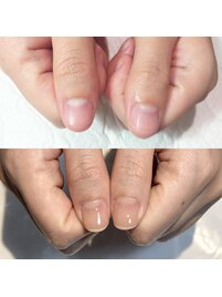 爪の悩みを解消出来るサロン