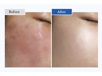 ティアム(TiAM)の写真/【話題沸騰・敏感肌にも◎】毛穴・くすみ・ざらつきをケア。韓国発”剥かない肌管理”
