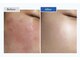 ティアム(TiAM)の写真/【話題沸騰・敏感肌にも◎】毛穴・くすみ・ざらつきをケア。韓国発”剥かない肌管理”
