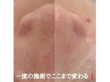 ソワン ド ボーテ ラフィネ(Soins de beaute Raffine)の雰囲気（【☆毛穴ケア☆結果重視】）