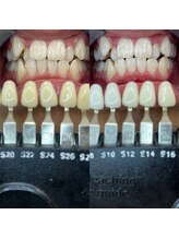 トウキョウスワーズ 池袋店(TOKYO SWRS)/#ホワイトニング #池袋 #渋谷