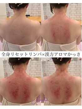 アンテ(Aunte.)/漢方アロマかっさ×リンパ