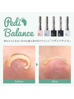 フェアリー 恵比寿店の写真/カラーも塗れる巻爪矯正！【ペディバランスコース￥10450】自爪育成で爪の悩みを解消◎