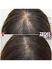 女性専用◆頭皮チェック&照射体験☆大人気!育毛促進美容液付き☆