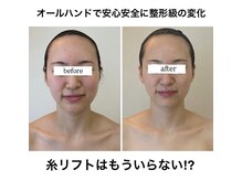 クレビア(CREBIA)/長年の輪郭のお悩みに