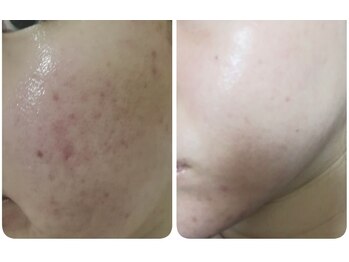 スリリアン 銀座/★お客さまビフォーアフター★