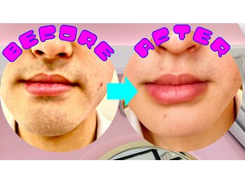 アムンドシャルム(Amun de Charme)