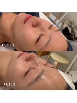 ロイヤル ビューティー サロン(Royal Beauty Saloon)/韓国発最新肌管理【セルマン】