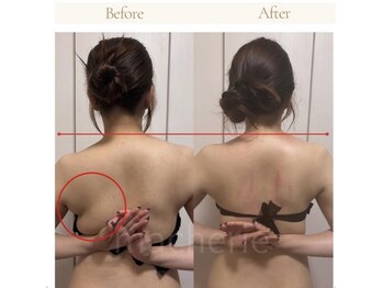 マシェリ(ma-che'rie)/3D肩甲骨剥がし+デコルテほぐし
