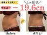 【産後太り解消】ママ応援ダイエット!全身痩身コース¥30,800→