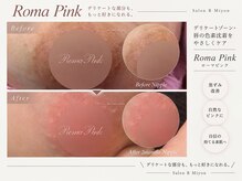 サロンアールミヨン(Salon R Miyon)の雰囲気（1度の施術で長年のお悩み解消！変化0の場合再施術保証◎分割◎）