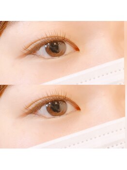 ビューティーホスピタル(Beauty Hospital)/ダークモカ×ブラック