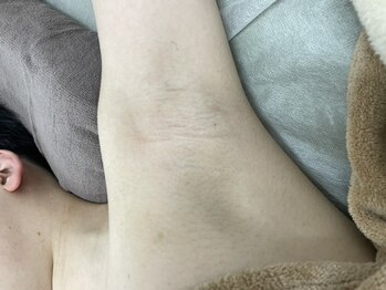 ナノハナ/鹿沼市全身脱毛美容室ナノハナ