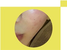 キュアフロウ 新潟巻/ヘルシー&ビューティー（8）