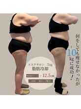 タグ 高知駅前店(Tug)/脂肪冷却