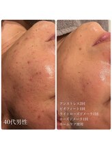 エクラ(eclat)/クリスティーナ