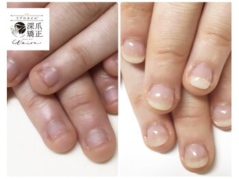 トイロ(toiro)/毎日、目にする爪だから