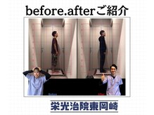 栄光治院 整体院東岡崎/肩こり・首の痛み解消！