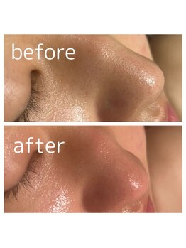 ピュアスキンサロン 恵比寿店(pure skin salon)/韓国肌管理【恵比寿渋谷】