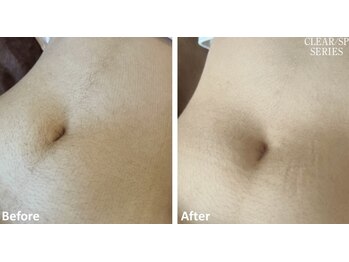 ベルフィオーレ(bel fiore)/