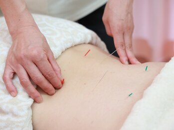 ビヨウフォーウーマン(Biyo For Women)の写真/海外での施術経験/学校の講師も務め、教え子多数◎実績抜群の院長が手掛ける《本当の美容鍼》