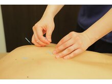 フォリオラ(Folivora)/はり施術