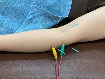 五反田駅前鍼灸整体院/電気鍼施術