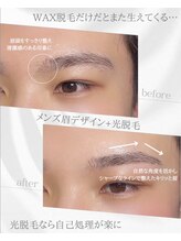リノア(Linoa)/メンズ眉毛ビフォーアフター