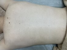 ナノハナ/鹿沼市全身脱毛美容室ナノハナ