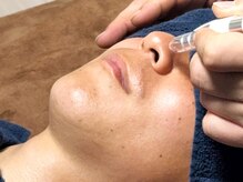 シェービーズ(shavys)の雰囲気（大人気！毛穴ケア♪ヒゲと毛穴同時にスッキリ）