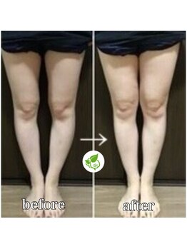 カイロプラクティック ネクサス/Ｏ脚撃退☆