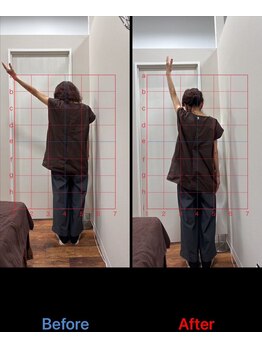 ラムーン(La.Moon)/肩の痛み施術