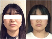 ウェリナ 一宮院/小顔矯正/骨盤矯正/痩身整体