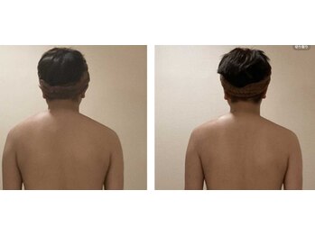 小顔コルギ専門店 フェルーシュ 成田駅前店(Feruche)/20代男性 結果写真