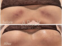アリリィ(ARILY)/ARILY after care salon