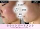 ラカ 長野駅前本店(LaKa)の写真