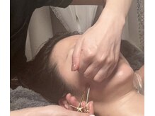 サロンドエムジョリー 横浜(Salon de M jolie)/刺さない美容の鍼で二重顎撃退！