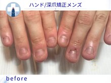 プラスワン(+1)の雰囲気（深爪、爪噛み、縦割れ、形...爪のお悩みを改善します[池袋]）